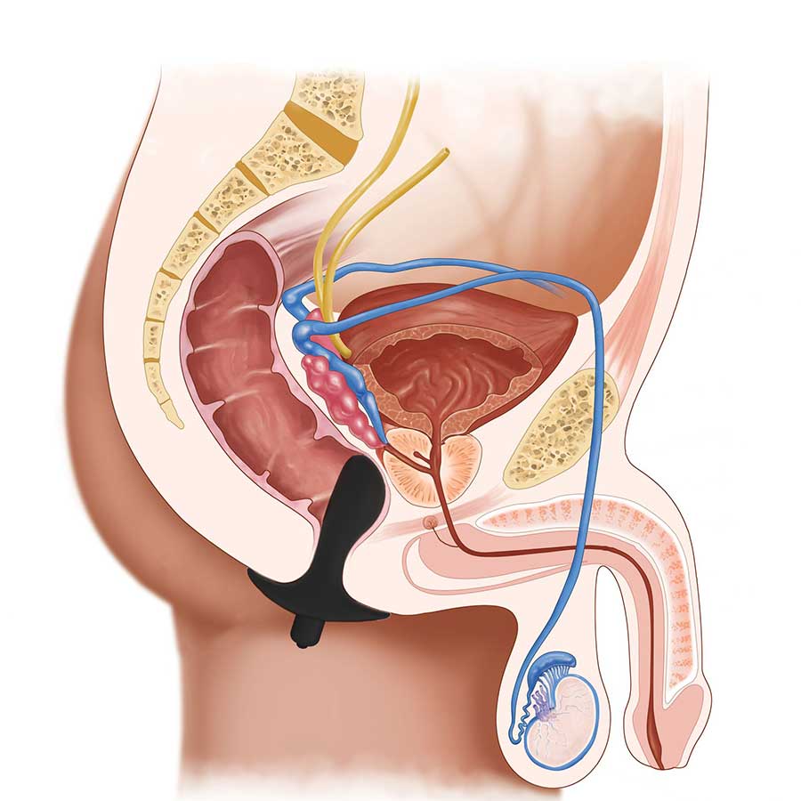 Starter Silicone Vibrating Prostate Massager - Image 4